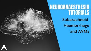 Neuroanaesthesia tute part 1 Subarachnoid haemorrhage and AVM [upl. by Lauder693]