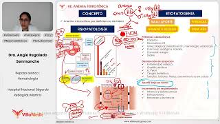 ANEMIA FERROPÉNICA  HEMATOLOGÍA  VILLAMEDIC [upl. by Eilyw]