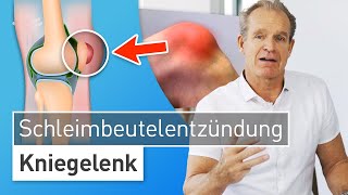 Knie angeschwollen und gerötet Das hilft bei Schleimbeutelentzündung am Knie  Dr Stefan Preis [upl. by Pelletier]