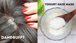 Yogurt Hair Mask  Dandruff Removal Treatment at Home  Yogurt For Dandruff [upl. by Medor]