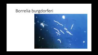 Batteriologia  lezione 19 Borrelia burgdorferi [upl. by Dalpe]