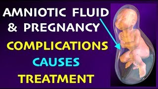 Amniotic Fluid Level and effect on pregnancy Complications Causes amp Treatment of Polyhydramnios [upl. by Helve579]