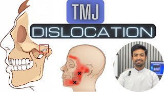 Anatomy of TMJ  Temporomandibular joint [upl. by Goodman]