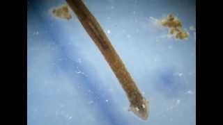 Planaria Phylum Platyhelminthes [upl. by Schilling]