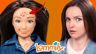 Doll with ACNE and Cellulite Lammily Doll Review [upl. by Sirret219]