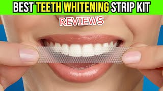 ✨ Transform Your Smile Crest 3D Whitestrips Kit Review 🦷  Does It Really Work [upl. by Eatnuhs902]