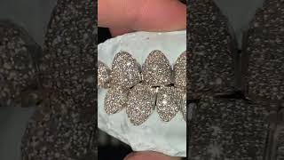 8 on 8 VVS Moissanite Diamonds Grillz  MoissaniteBazaarcom [upl. by Tenay]