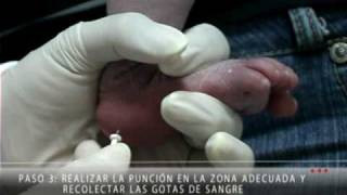 Forma Correcta de Recolectar la Muestra para el Tamiz Neonatal [upl. by Noizneb189]