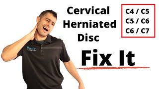 How We Treat a Herniated Disk  Physical Therapy [upl. by Idna]