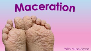 Understanding Wound Maceration [upl. by Luebke]