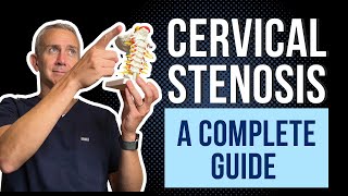 Cervical Spine Stenosis  A Complete Guide [upl. by Blinny]