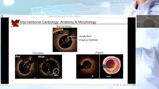 Towards ImagingBased Patient Stratification for Interventional Cardiology and Nephrology [upl. by Ienttirb]