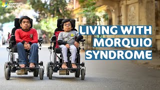 My Story  Living with Morquio syndrome [upl. by Kylynn]