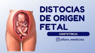 Distocias de origen fetal [upl. by Samau]