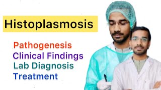 Histoplasmosis  Pathogenesis  Clinical Diagnosis  Treatment [upl. by Aidroc]