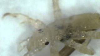 Watch a lice louse hatch under a microscope [upl. by Suirauqed963]