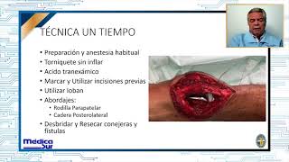 Alternativas en el tratamiento de infecciones periprotésicas ¿Es seguro [upl. by Aisenat]