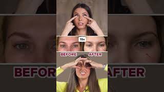 HOW TO REMOVE UNDEREYE BAGS LINK IN BIO [upl. by Gertruda]