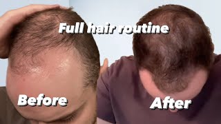 How to Help Regrow Your Hair UPDATED VITAL INFO [upl. by Boucher]