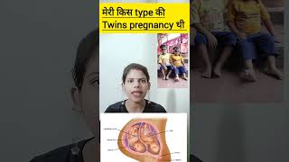 meri kis type ki twins pregnancy thi dichorionic diamniotic twins pregnancy ka kya matlab hota hai [upl. by Aratnahs331]