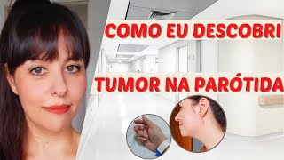 Como eu descobri meu tumor de parótida glândula salivar [upl. by Calysta]