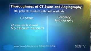 CT scans vs coronary angiography [upl. by Sigismundo]