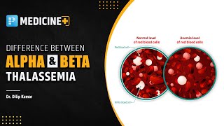 Alpha vs Beta Thalassemia  Prepladder NEET SS [upl. by Erised837]