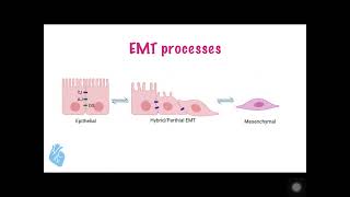 Tetralogy of fallot TOF English version [upl. by Airel]