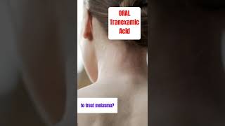 tranexamic acid ORAL for melasma treatment shorts [upl. by Adiasteb]