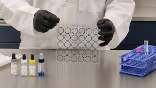 Anticuerpos antinucleares y antiDNA [upl. by Enyleve563]