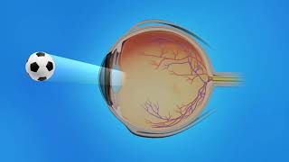 AgeRelated Macular Degeneration AMD Types Causes Symptoms Treatment [upl. by Streeter333]