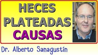 HECES PLATEADAS ▶ ¿Sabes las Causas [upl. by Schwenk]