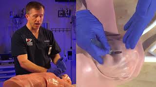 Emergency Bougie Cricothyrotomy Procedure Explained [upl. by Elleinet]