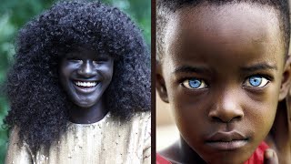 Top 15 Rarest Black People in The World That Are 1 In A Million [upl. by Aizahs809]