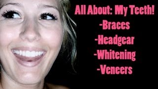 All About My Teeth Braces Headgear Whitening and Veneers [upl. by Ahseeyt309]