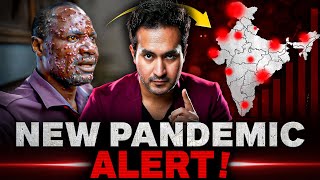 ALERT New PANDEMIC is Spreading Across The World  MPOX Virus Explained [upl. by Rajewski]