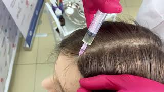 Применение Apriline Meso Hair Line [upl. by Drusie]