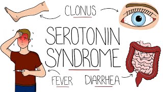 Serotonin Syndrome Explained Serotonin Toxicity [upl. by Annaitsirhc951]