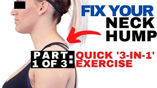 QUICK Fix for Neck Hump  Dowagers Hump Fix  How to Get Rid of a Neck Hump [upl. by Eiramana554]