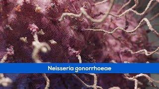 Medical Animations  Bacteria Gonorrhoea [upl. by Lucchesi462]