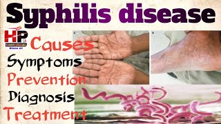 Syphilis disease  STD kya hai  How to spread syphilis Causes symptoms prevention treat [upl. by Neuburger]