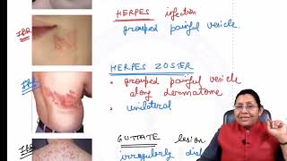 DERMATOLOGY RAPID REVISION [upl. by Eenaej]