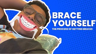 Brace Yourself😁 The Process of Getting Braces On [upl. by Enovi500]