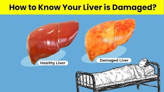 Decoding FibroScan What Your Liver Health Results Really Mean [upl. by Einnal]