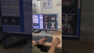 3D reconstruction ct Urography ctscan ctscantechnician trendingshorts tyshorts shortvideo [upl. by Einaffyt]