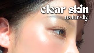 How I Cleared My Skin In 8 Weeks naturally [upl. by Youngran]