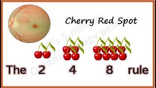 Cherry Red Spot [upl. by Odnavres]