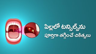 Causes and Cures for Tonsillitis and Adenoiditis in Children in Telugu  టాన్సిల్స్ వాపు [upl. by Aihsikal728]