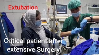 Extubation how to extubate critical patient after extensive Surgery without complications [upl. by Sherfield]