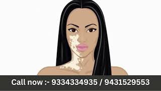 Vitiligo Laser Treatment at HLCCS RANCHICall now  9334334935 vitiligo vitiligoawareness [upl. by Becky587]